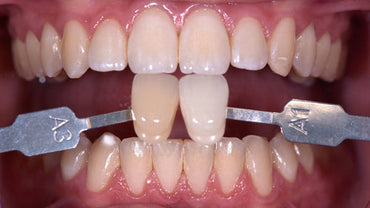 WALDENT SHADE GUIDE CLINICAL (VITA STANDARD)