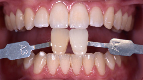 WALDENT SHADE GUIDE CLINICAL (VITA STANDARD)